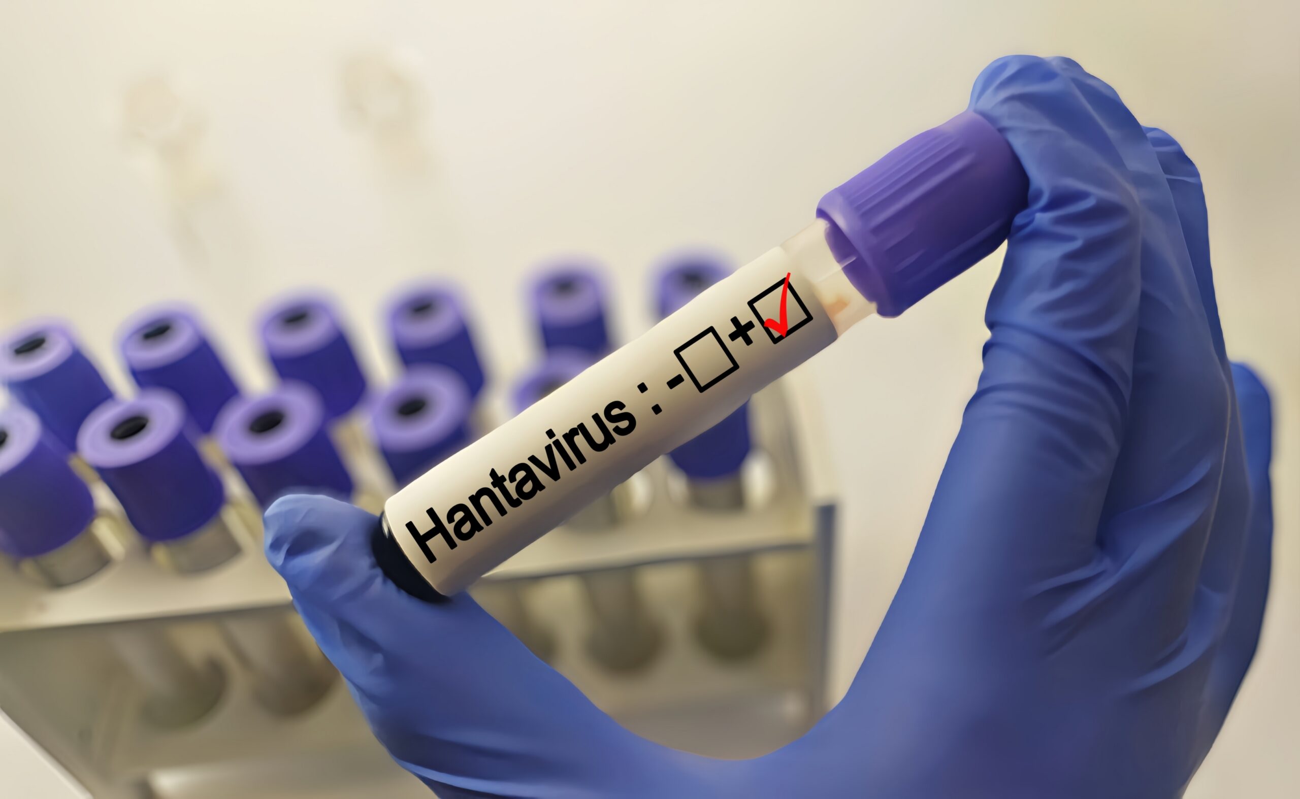 Featured image for “Hantavirus Reveals Latin America Is Unprepared, Warns The Lancet Commentary”